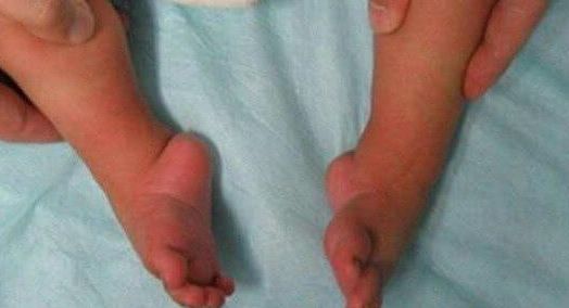 足部健康小知识,足脊健康知识