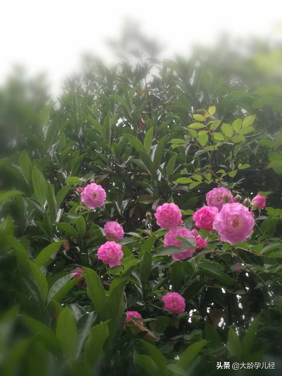 剖腹产20天后可以做哪些产后恢复,刨腹产妇产后需要注意什么