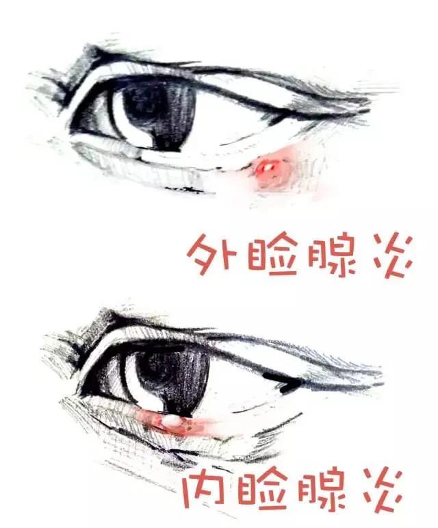 眼皮上长痘是麦粒肿吗,眼皮长痘是针眼吗