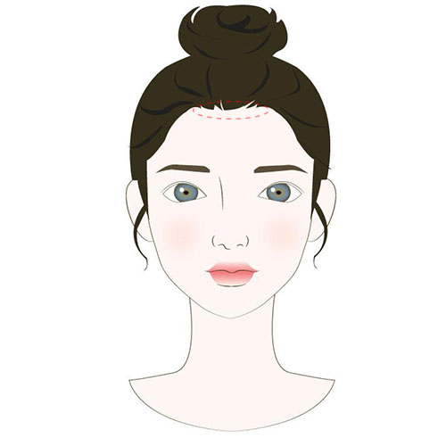 腮边长痘是什么原因,眉心长痘是什么原因