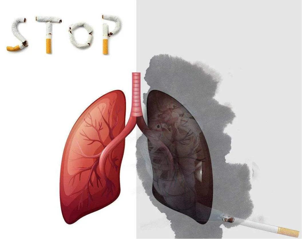 肺结核最忌口的食物鱼可以吃吗,肺结核ppd做完有没有什么饮食忌口