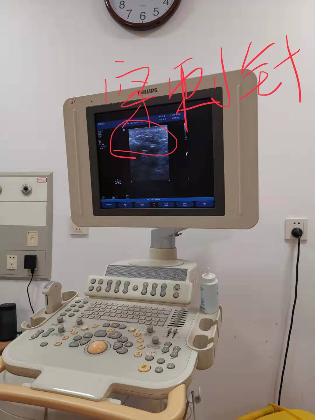 “小护”详解乳腺穿刺活检术，让您不再恐惧这项重要检查