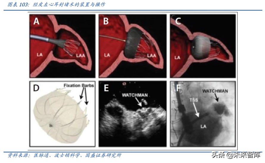 乐普医疗心血管专科医院,乐普医疗的战略