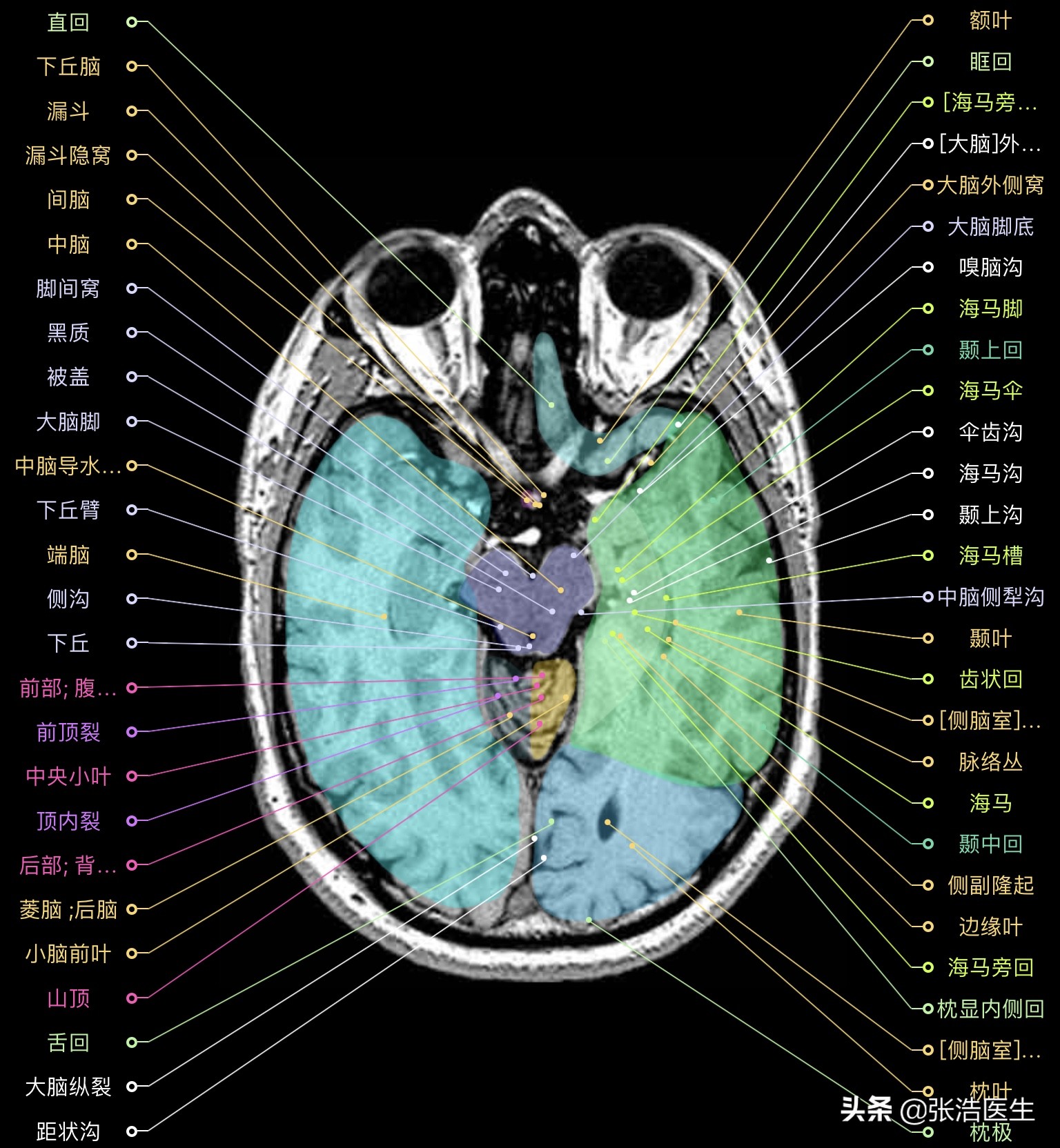 颅脑mri断层解剖视频课件,颅脑mri解剖手绘图