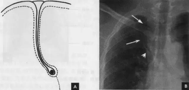 休闲小白鞋夏,献血小板相当于献血多少