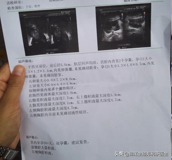 取完卵后有点腹水可以移植吗,取完卵后有腹水还可以移植吗