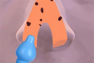 冬天洗完澡给宝宝擦什么好,几个月的孩子可以用洗鼻水