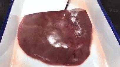 纳米技术让伤口快速愈合的凝胶,神奇胶水60秒缝合伤口