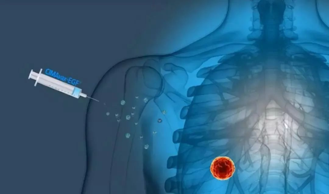 癌症疫苗或一针清除癌症,癌症疫苗可以摧毁所有癌症吗