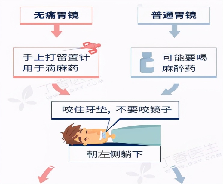 做胃镜的流程及注意事项,胃镜做无痛的好还是普通胃镜安全