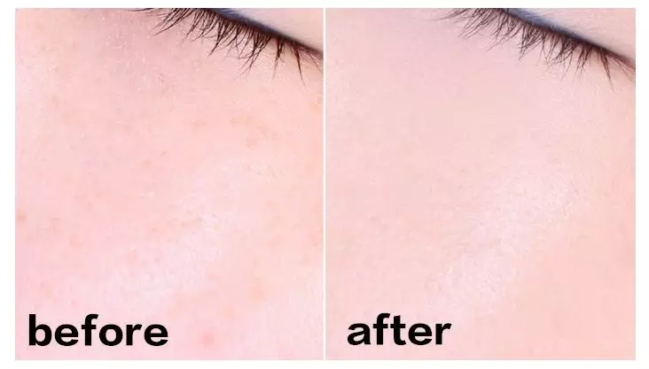 14款气垫合集！一篇解决干皮、油皮所有问题！