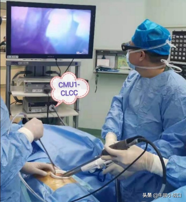 磨玻璃影肺腺癌切除最佳时机,肺磨玻璃结节ggo和ggn各表示什么