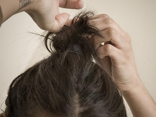 掉发太烦恼？头发稀少想要变浓密，网友：学到了