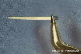 纤维桩修复费用,纤维桩修复全过程视频