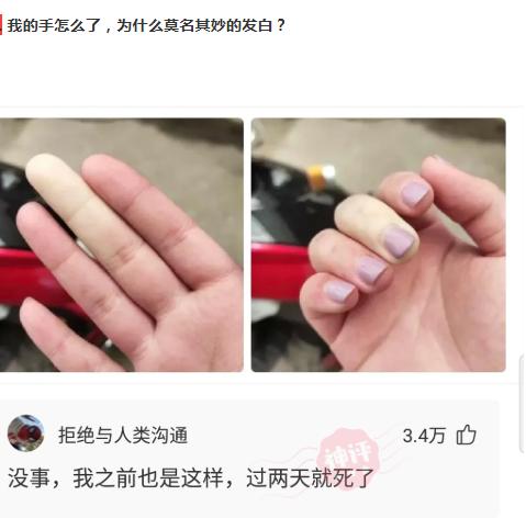 爬山回来手指头长毛什么梗,爬山回来手指头长了几根毛