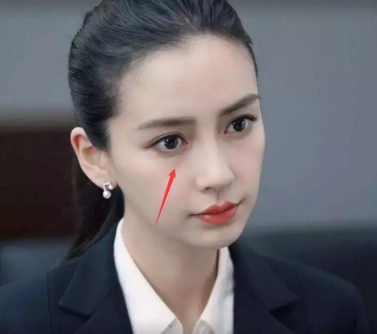 去眼袋15年后有细纹怎么办,祛眼袋之后会不会看着很平