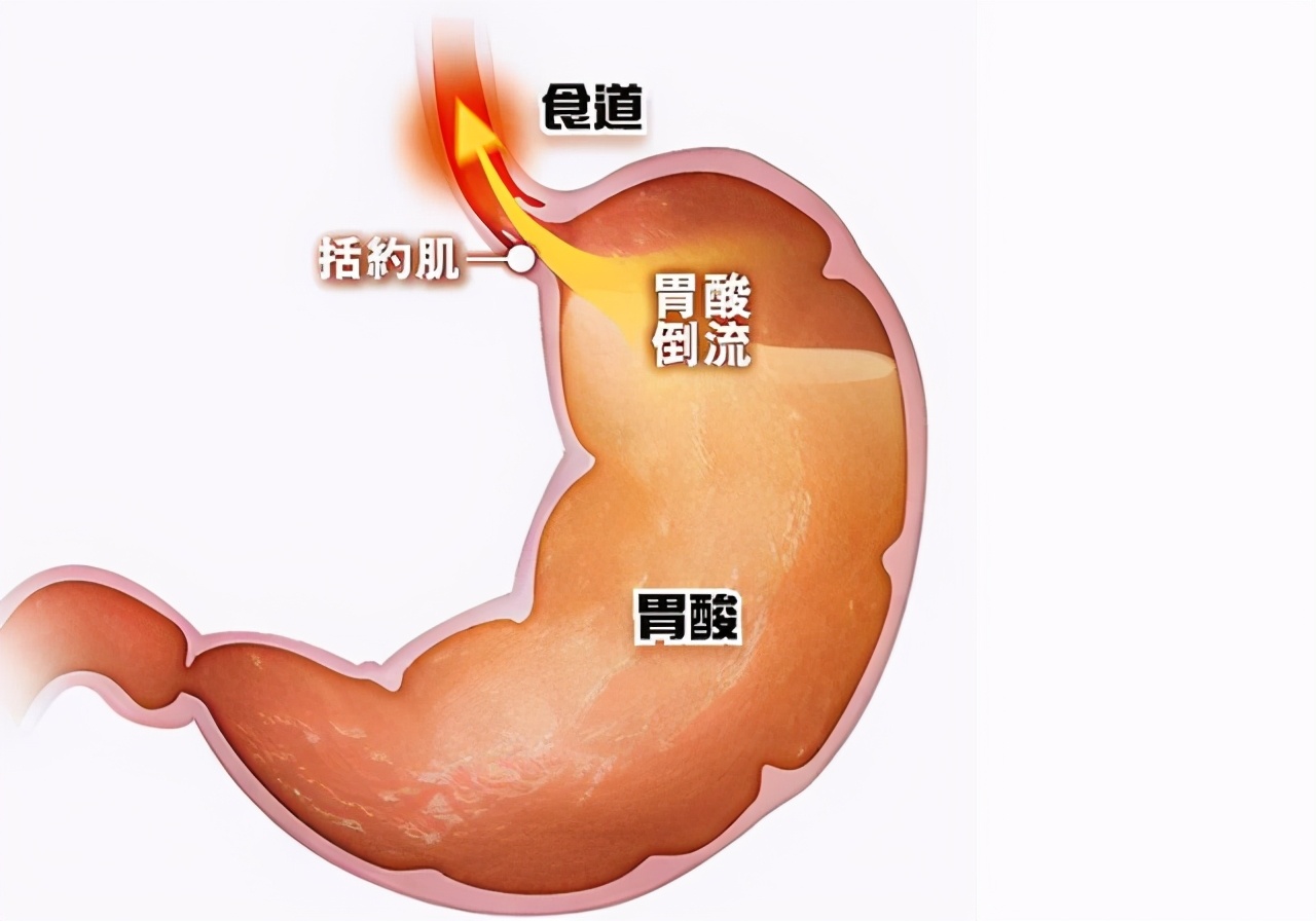 胃酸烧心吃奥美拉唑要吃多长时间,胃酸烧心吃奥美拉唑可以吗