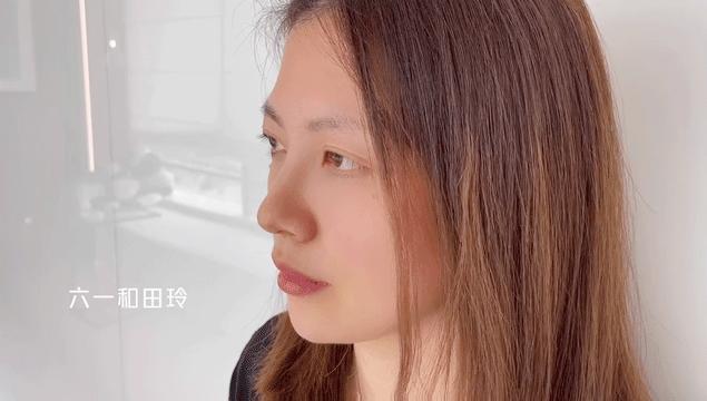 带娃长期熬夜的眼袋怎么去除,女人35岁以后一熬夜眼袋深怎么办