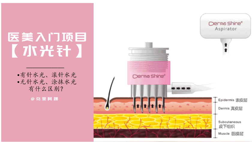 水光针无针孔还是有针孔的好,水光针有针管注射吗