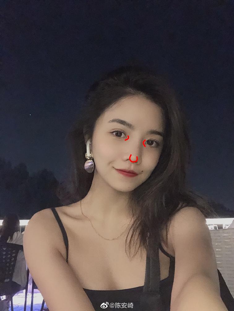 媒婆痣安崎,安崎要不要遮痣