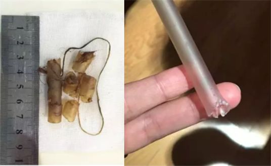 我家猫吞了根针险些丧命，这些东西千万别让猫碰