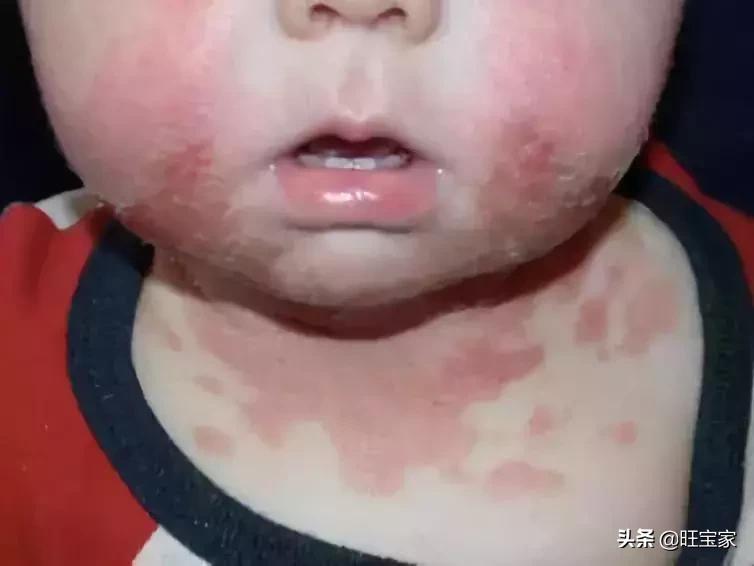 宝宝一直流口水是因为什么原因,宝宝经常流口水原因其实是这样的