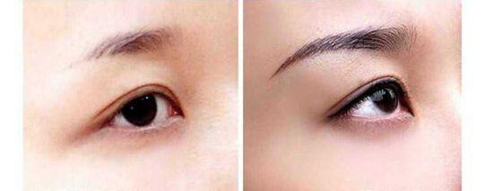 做半永久多少钱,做半永久眉毛后悔期