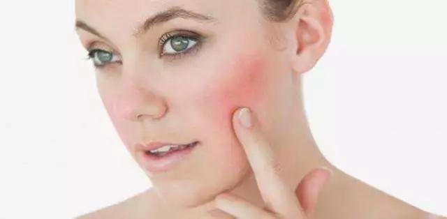 敏感肌肤春季怎么修复小妙招,为什么春天敏感肌肤特别多