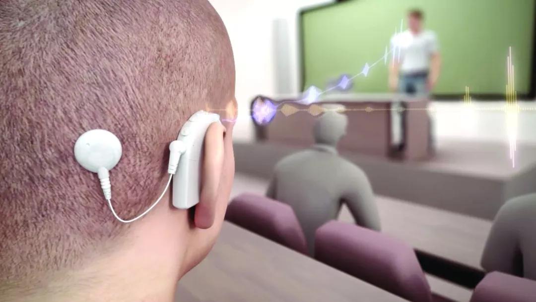 人工耳蜗专用麦克风研制成功,麦克风工作原理