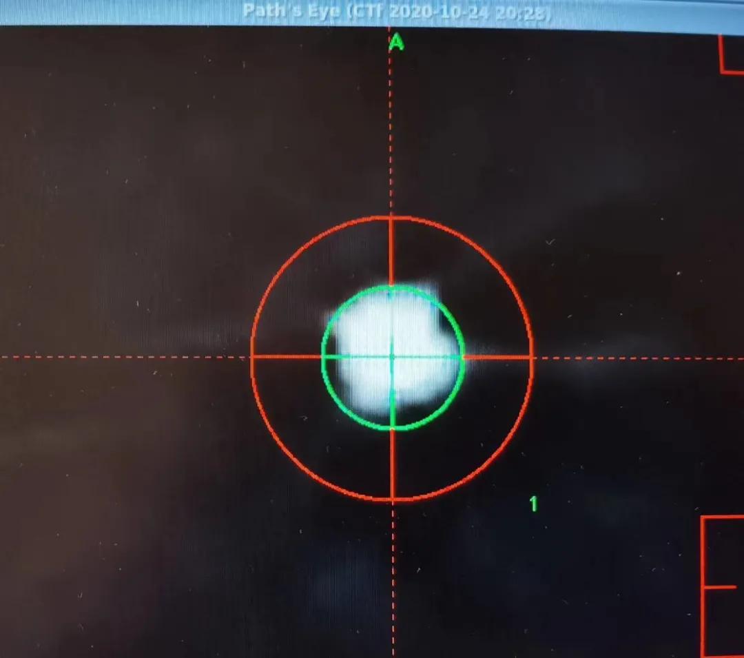 痉挛性斜颈如何治疗为好,痉挛性斜颈如何治疗你了解吗