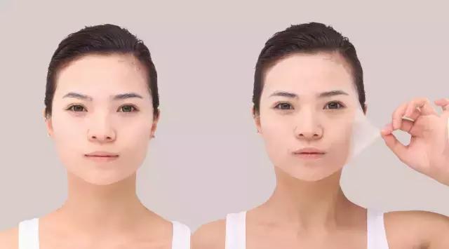 脸上敷面膜过敏长痘了怎么办,易过敏长痘用什么面膜