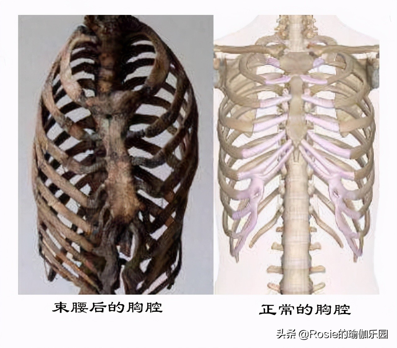 眼馋陈卓璇巴掌腰，竟靠束腰勒小腰？做对一个动作一周瘦出小蛮腰