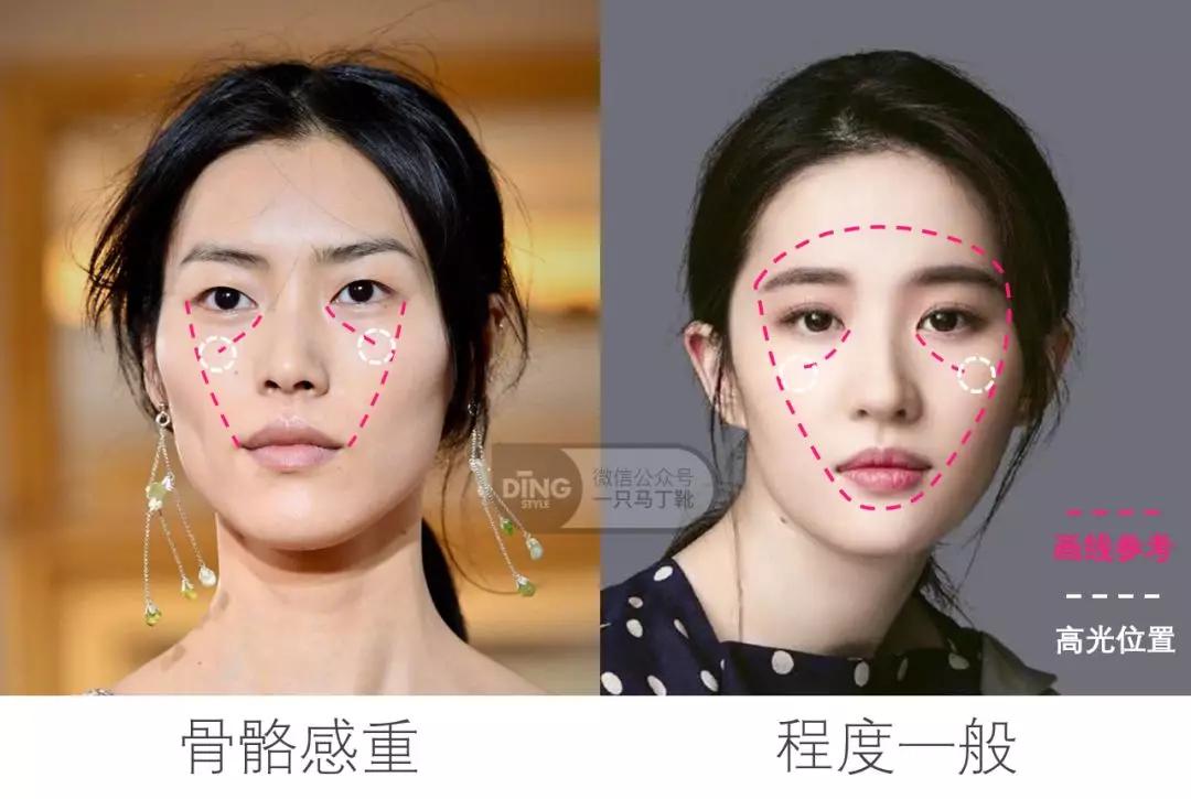 颧弓高脸型怎么改善,有泪沟可以通过调整脸型改善嘛