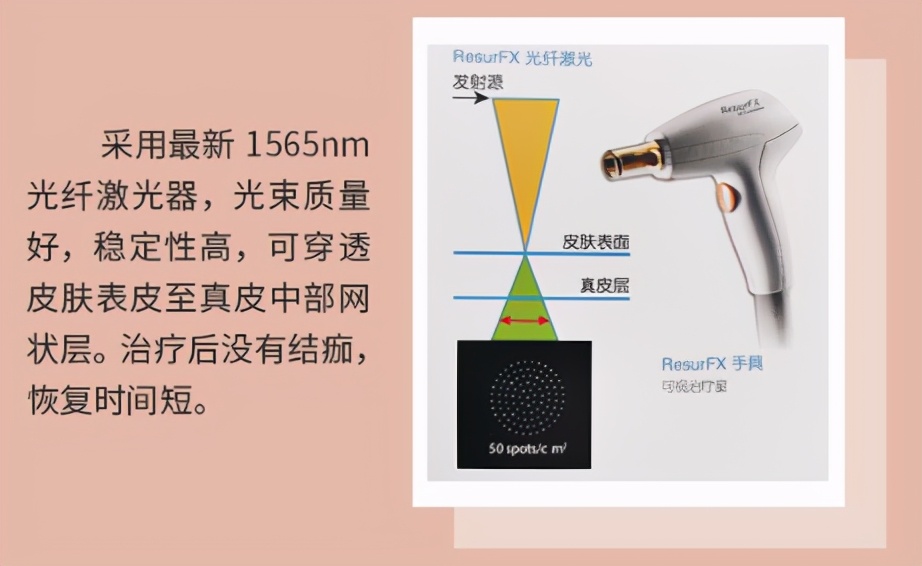 明星都在做的医美,光电光子嫩肤