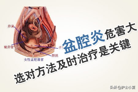 女人得了盆腔炎症该注意哪些,盆腔炎怎么预防和改善