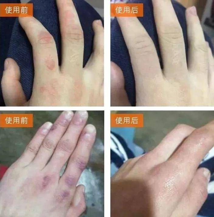 片仔癀紧致抗皱补水提亮水乳,片仔癀适合干性皮肤的面霜