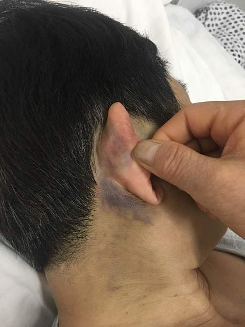 花果山车被撞,花果山被山地车撞