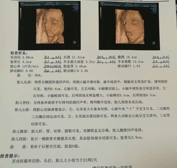 四维彩超图片孩子少一块,四维彩超图看孩子准确