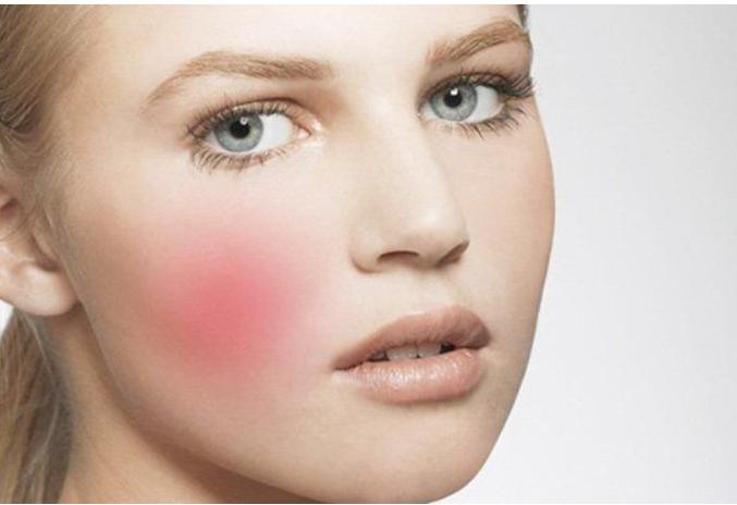 敏感肌红血丝易泛红怎么消除,敏感肌红血丝在护肤时应注意什么