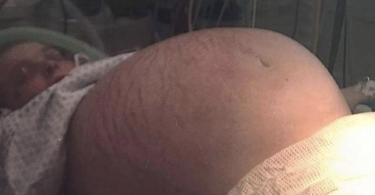 孕检很重要,怀孕会让卵巢囊肿跟着变大吗