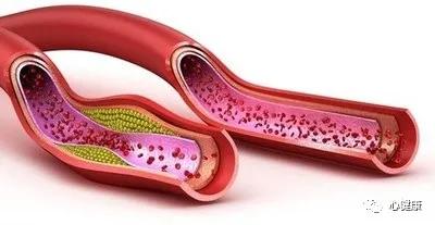 华为腕式血压计测血压准确吗,小米腕式血压计测血压准确吗