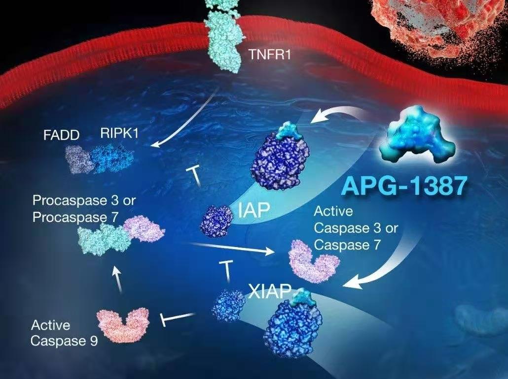 特发性间质肺炎ulp是什么,间质性肺炎uip改变可以治吗