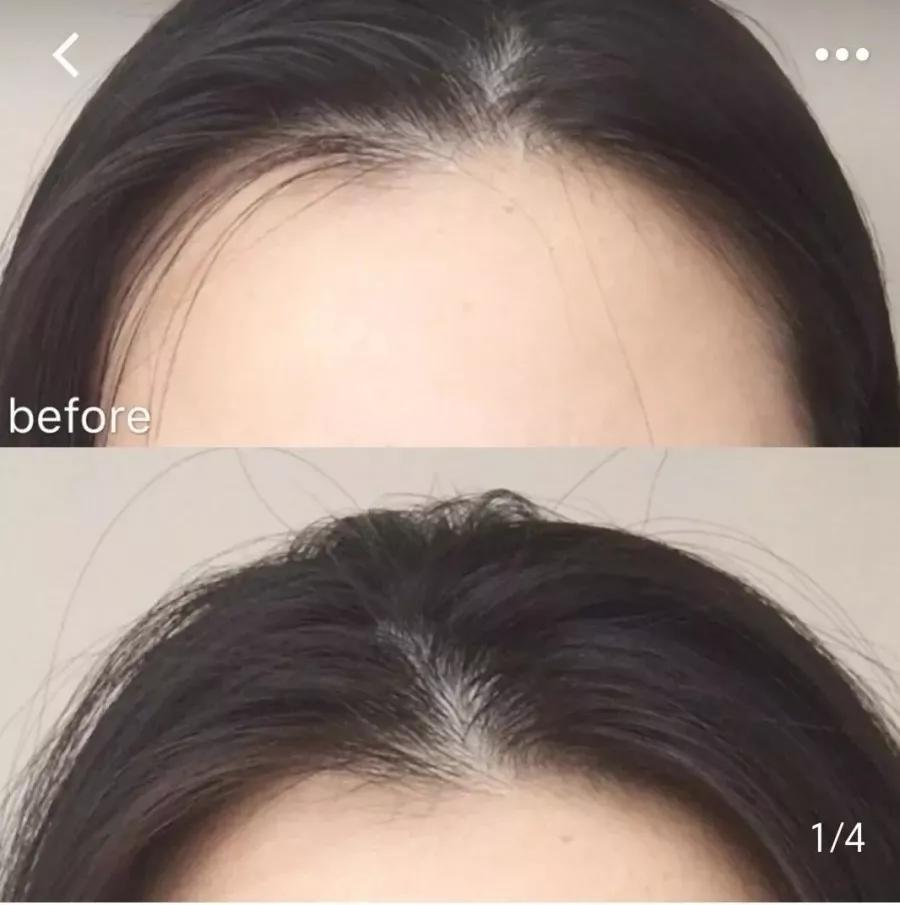 头发爱出油用什么可以变蓬松,头发油怎么才能头发蓬松干爽