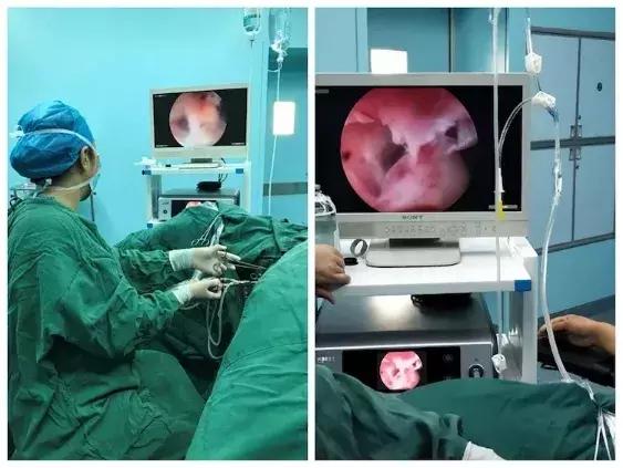 好消息！靖边县医院妇产科新增了多项新技术！