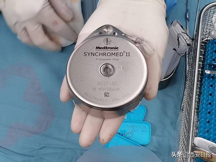 一泵“镇”顽痛！交大一附院鞘内药物输注泵植入术迈进止痛“高速公路”