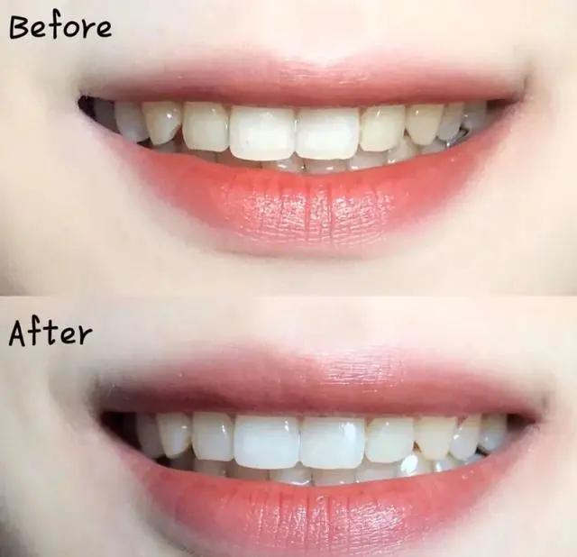 一张嘴就臭,一张嘴就口臭小妙招