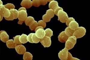 类风湿性关节炎和老寒腿一样么,老寒腿风湿关节炎