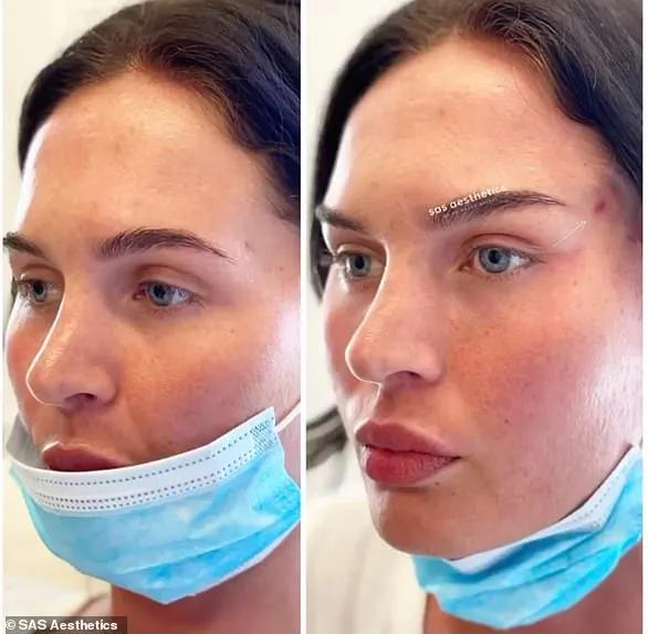 亚洲人“丹凤眼”成西方热门整容项目？一边歧视一边悄悄整容？