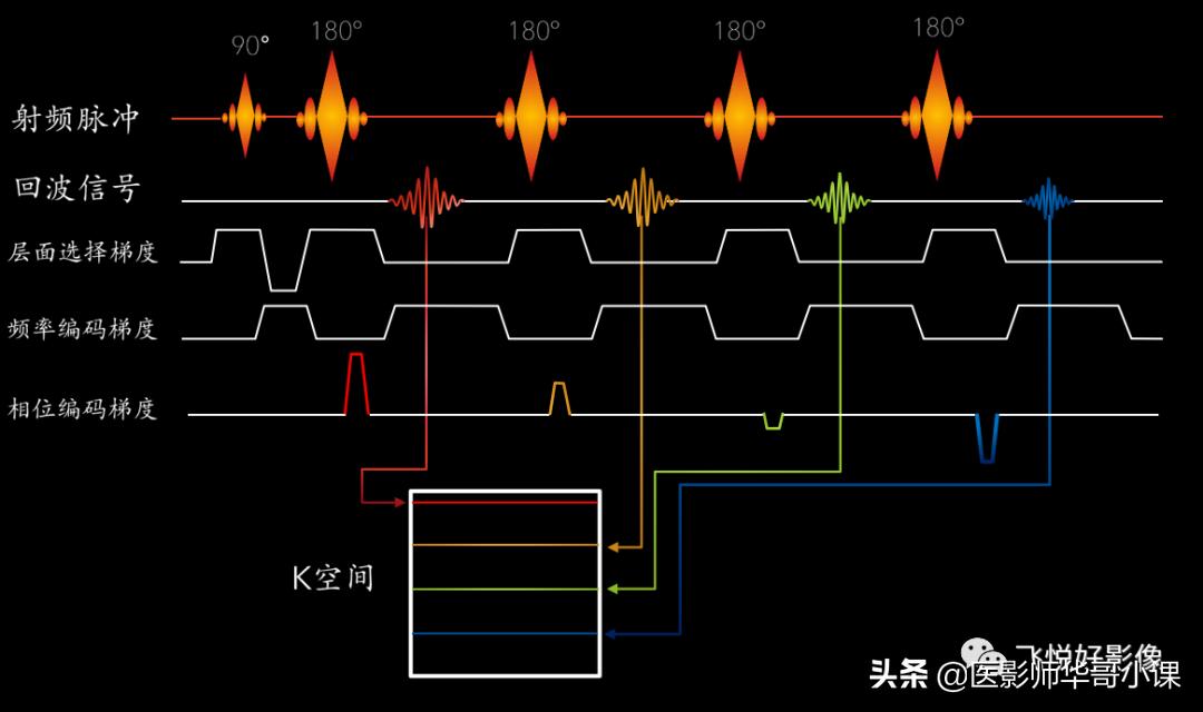飞利浦磁共振波谱扫描方案,飞利浦1.5t磁共振mri操作使用手册