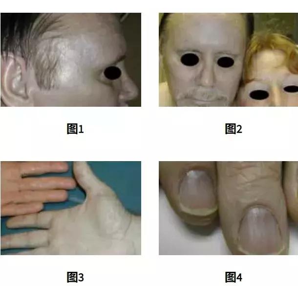 返老还童的一剂药,返老还童药真的有用吗